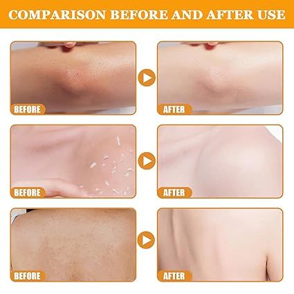 Orange Exfoliating Gel Removal Deeply Cleansing Long Lasting
